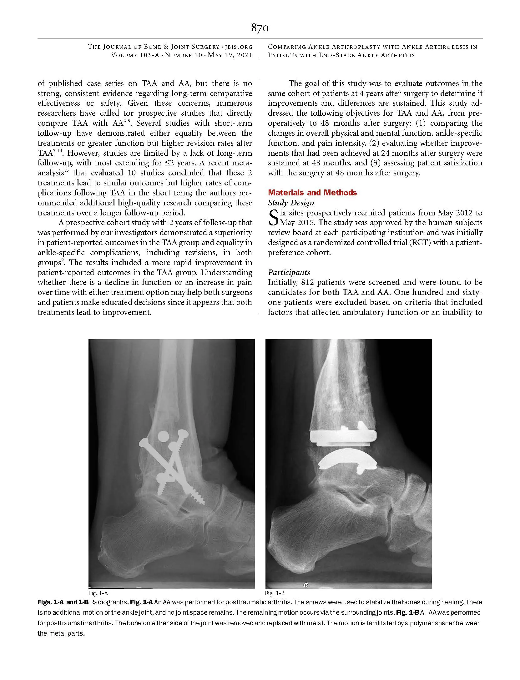 Comparing 4 Year Changes in Patient Reported.4 Page 02 Comparing 4-Year Changes in Patient-Reported Outcomes Following Ankle Arthroplasty & Arthrodesis | Amber Vance, ACNP-C, FNP orthopedic spine surgeons