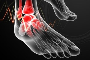 Why Does My Ankle Hurt For No Reason?