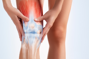 The structure of a person’s knee with patellofemoral knee pain